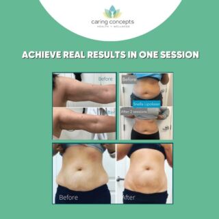 Real Results, One Session: Experience the Snella Transformation 🌟

Call/text 904-518-9545,
email ccwellnesscenterjax@gmail.com,
or visit our website cchealthandwellnessjax.com.
Let’s embark on your journey to beauty and wellness together!
.
.
.
.
.
.
.
.
.
.
.
 #InstantTransformation #SnellaMagic#InstantResults #SnellaMachine #OneSessionTransformation #RealResultsFast #SnellaEffect #QuickBeautyFix #EffortlessTransformation #FastBeautySolutions #SnellaRevolution #ImmediateResults